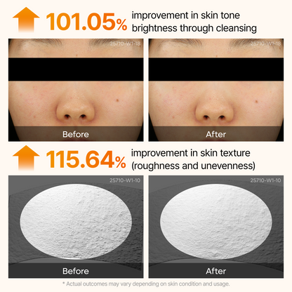 Peel Shot kojic Acid Turmeric Serum