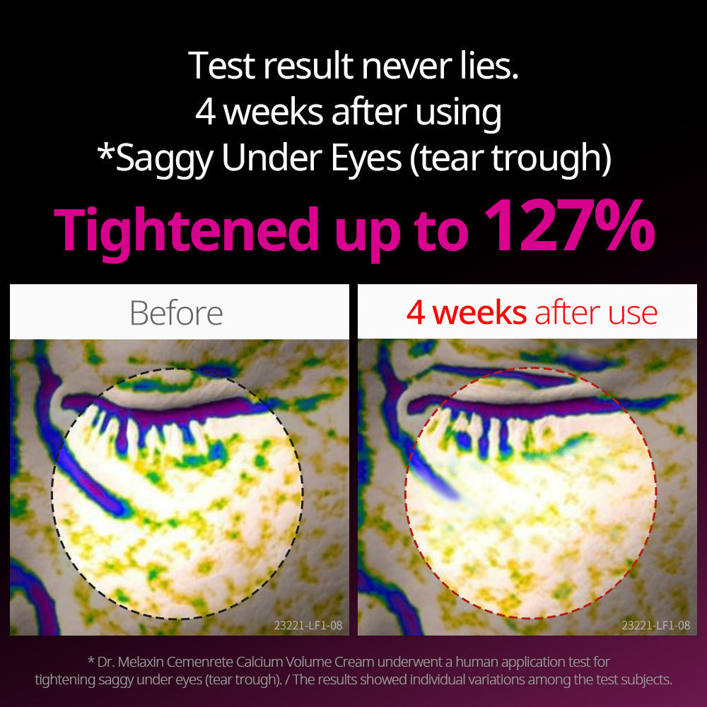 Cemenrete Eye care Line