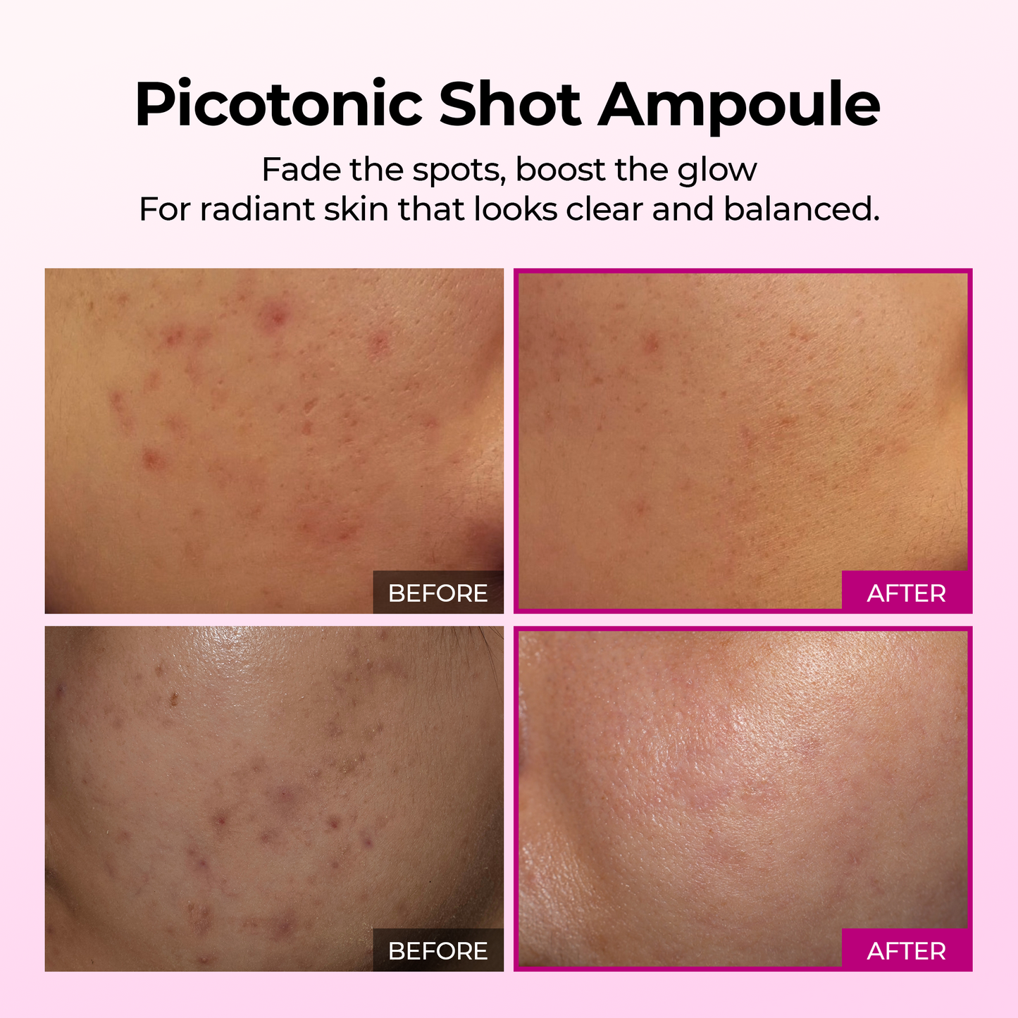Picotonic Shot Pigmentation Ampoule