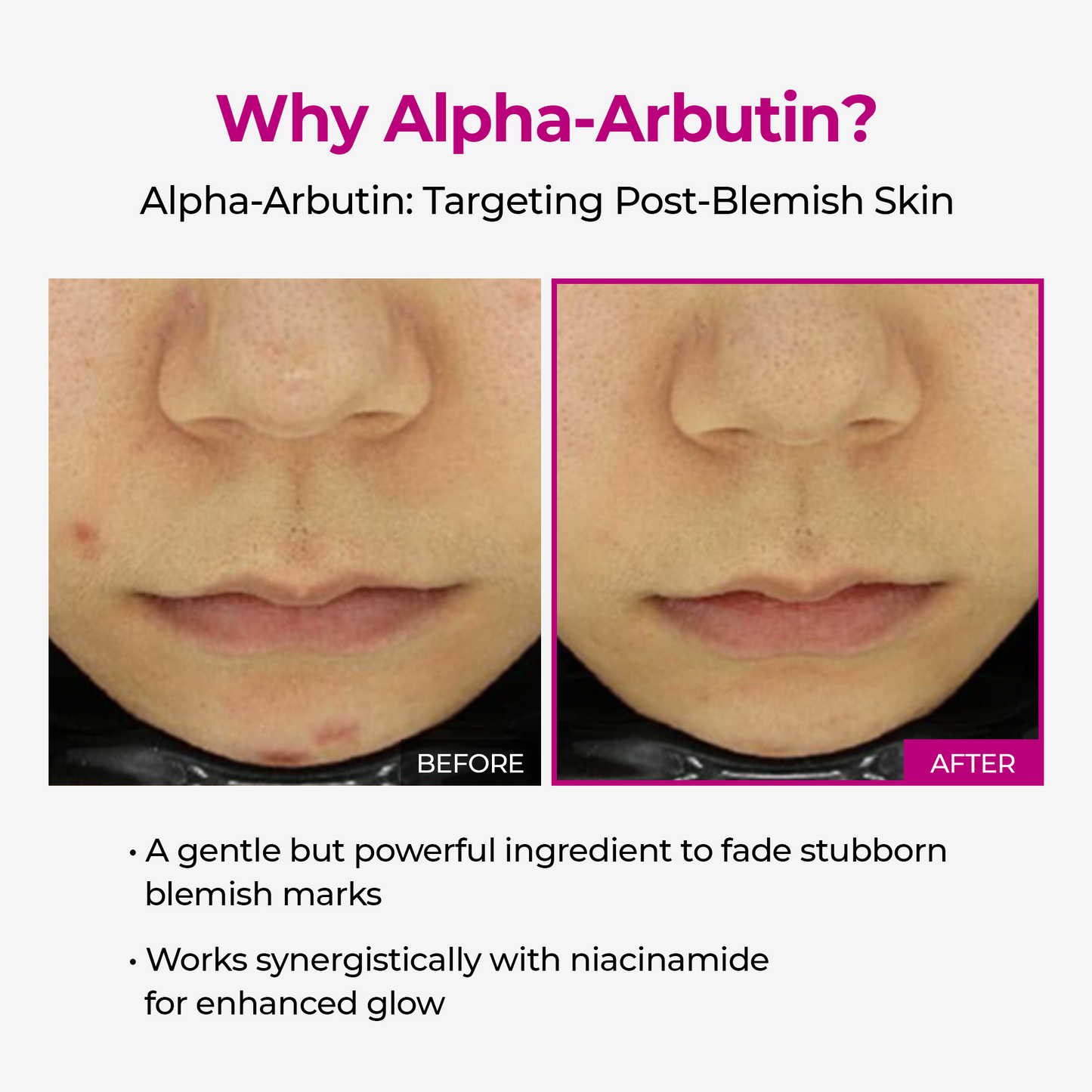 [LUCKY BOX] 3+1 Collagen Firming Set